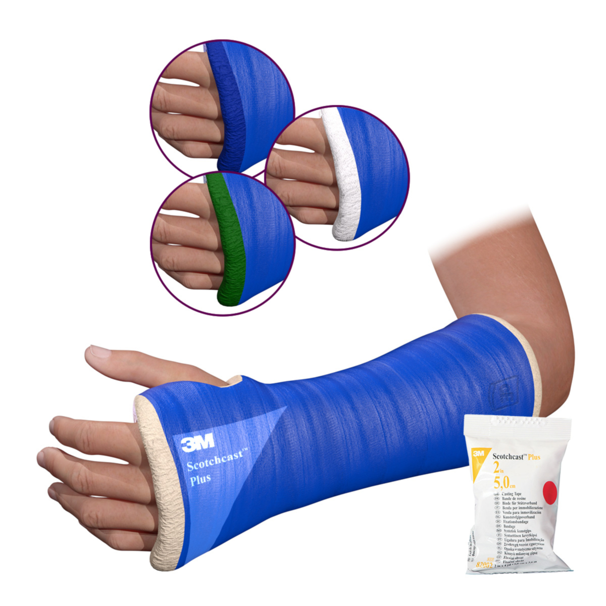 Scotchcast Plus Set Unterarm Frottee